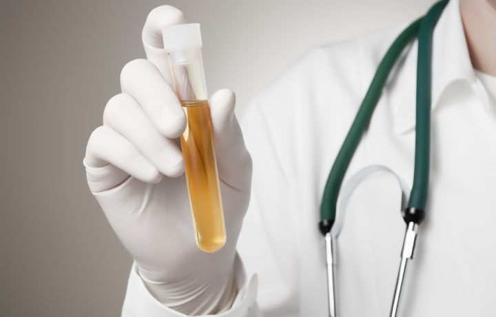 전립선염 진단방법