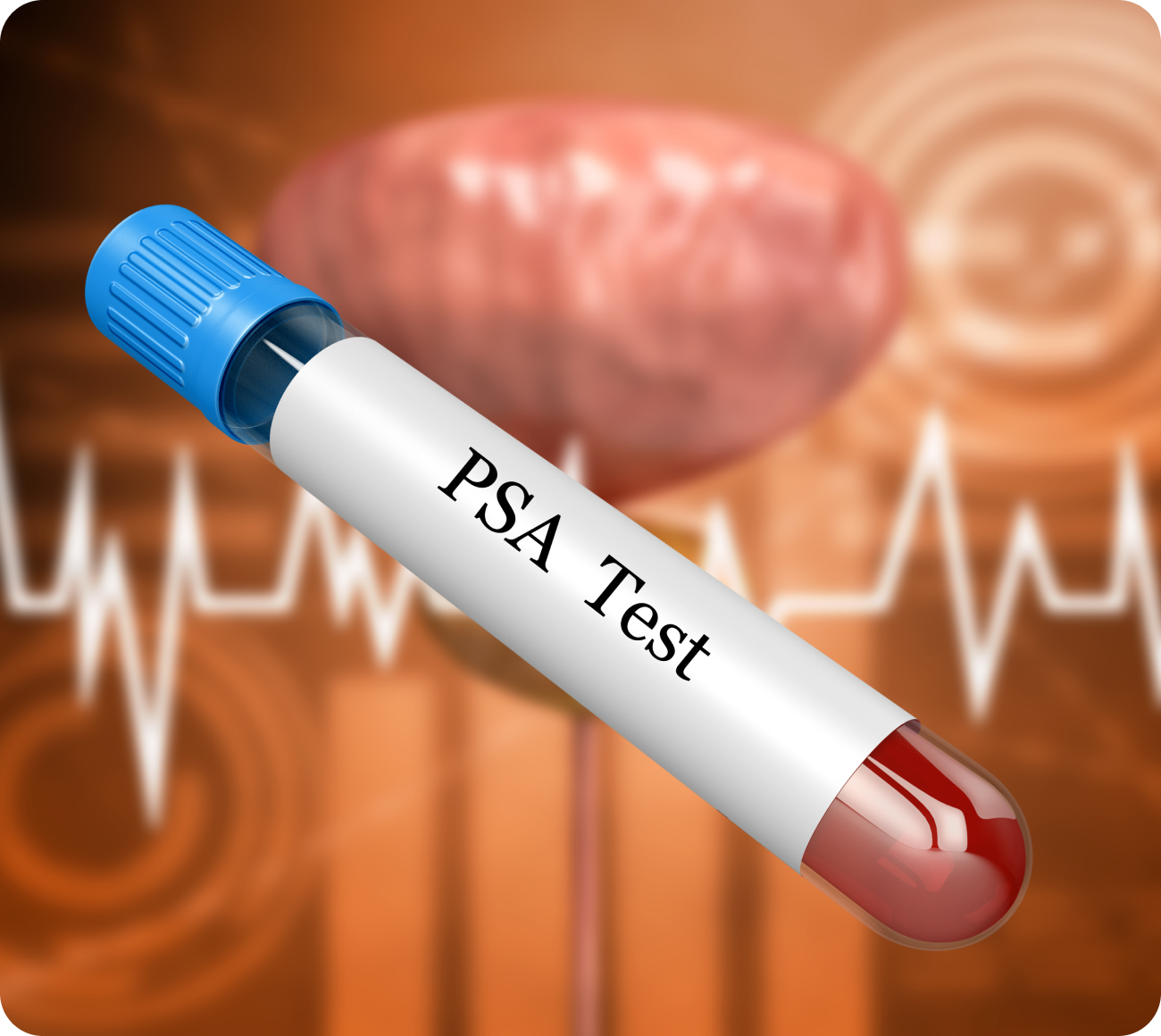 전립선비대증 PSA 검사