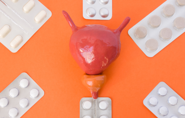 전립선비대증 약물치료