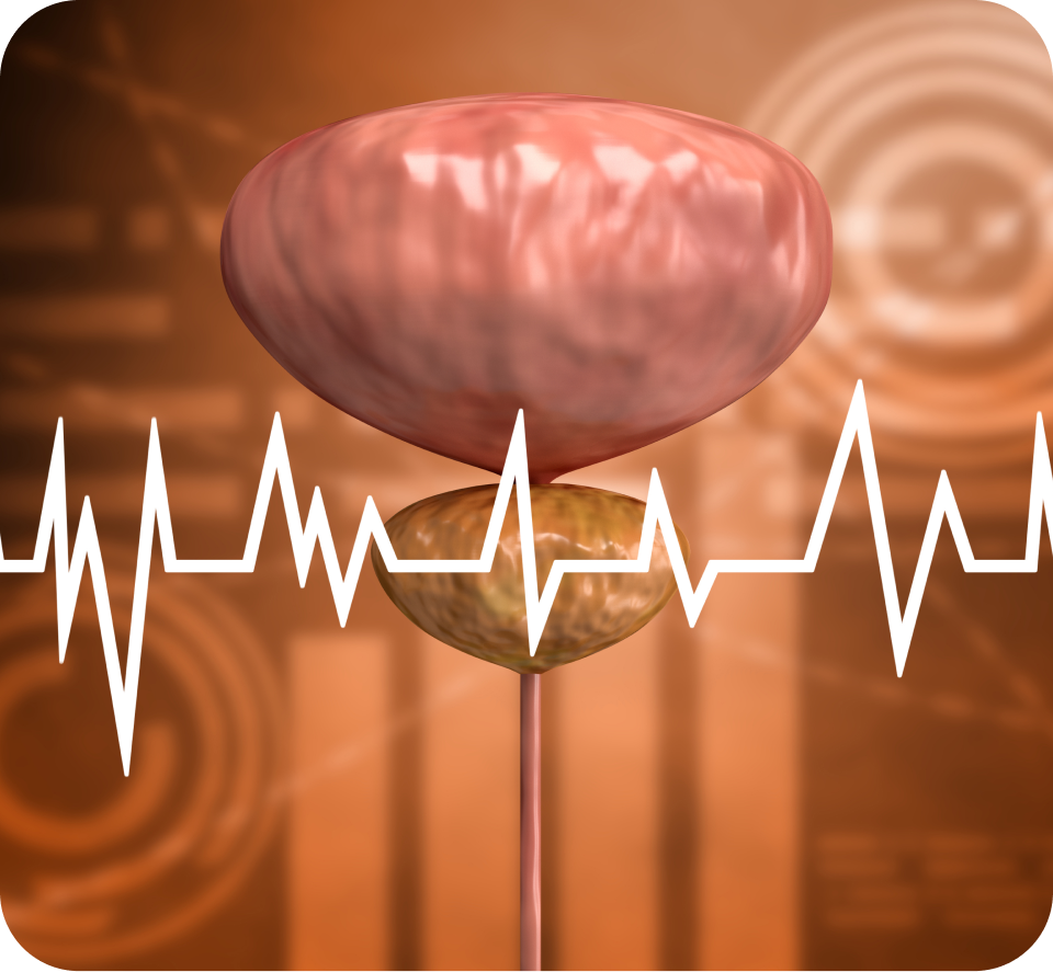 전립선비대 예방